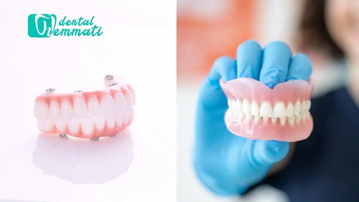 ایمپلنت دندان یا دندان مصنوعی