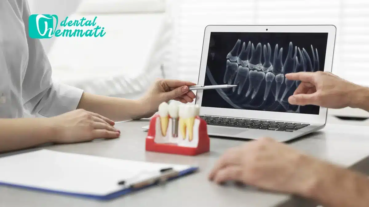 منع ایمپلنت دندان