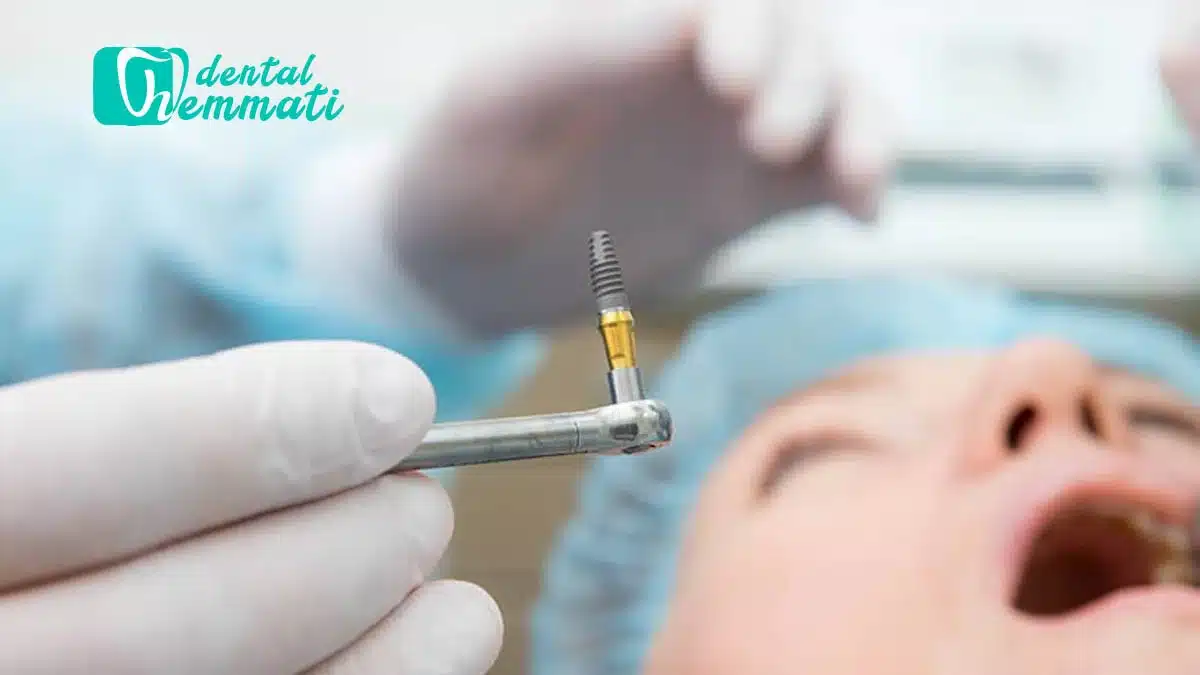 کاشت ایمپلنت و بازسازی استخوان فک