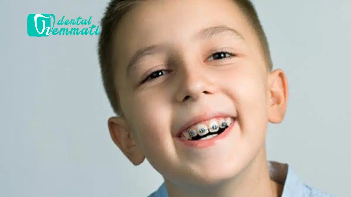 قبل از شروع ارتودنسی