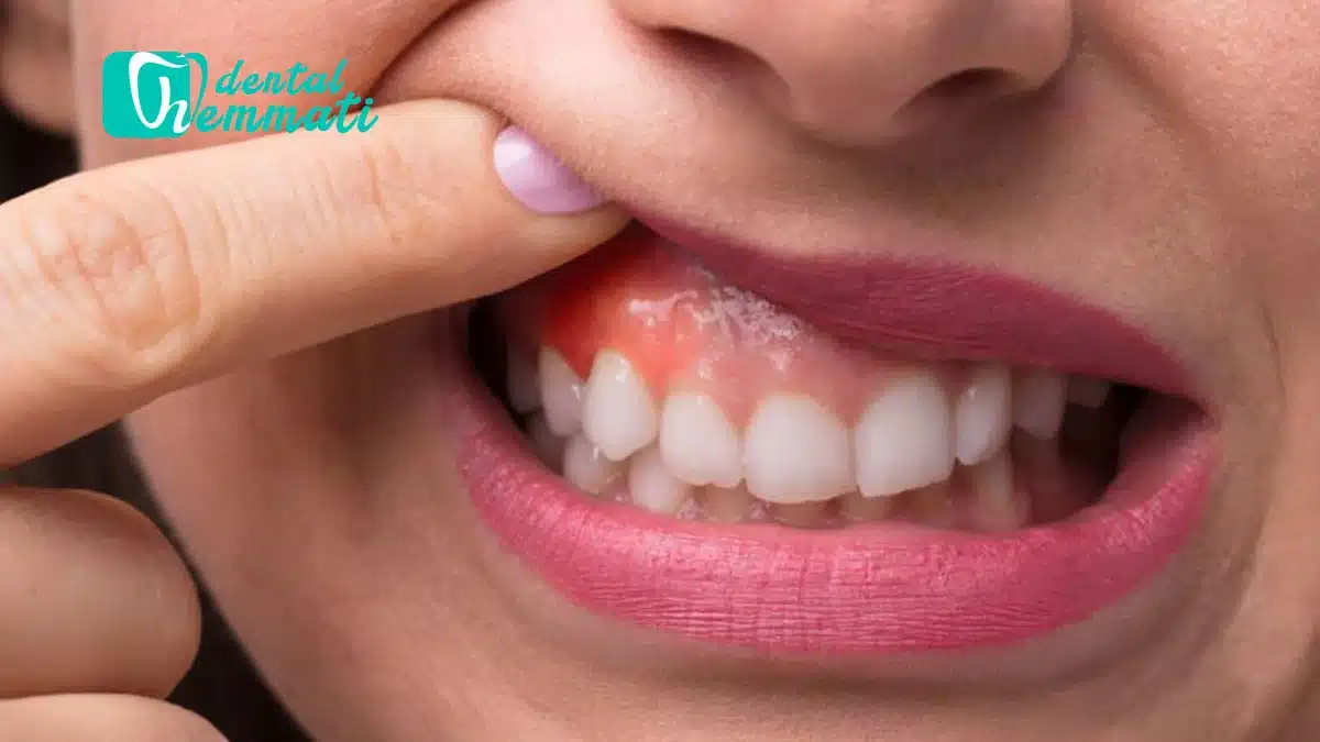 اگر لثه تحلیل رفته باشد، ایمپلنت ممکن است؟