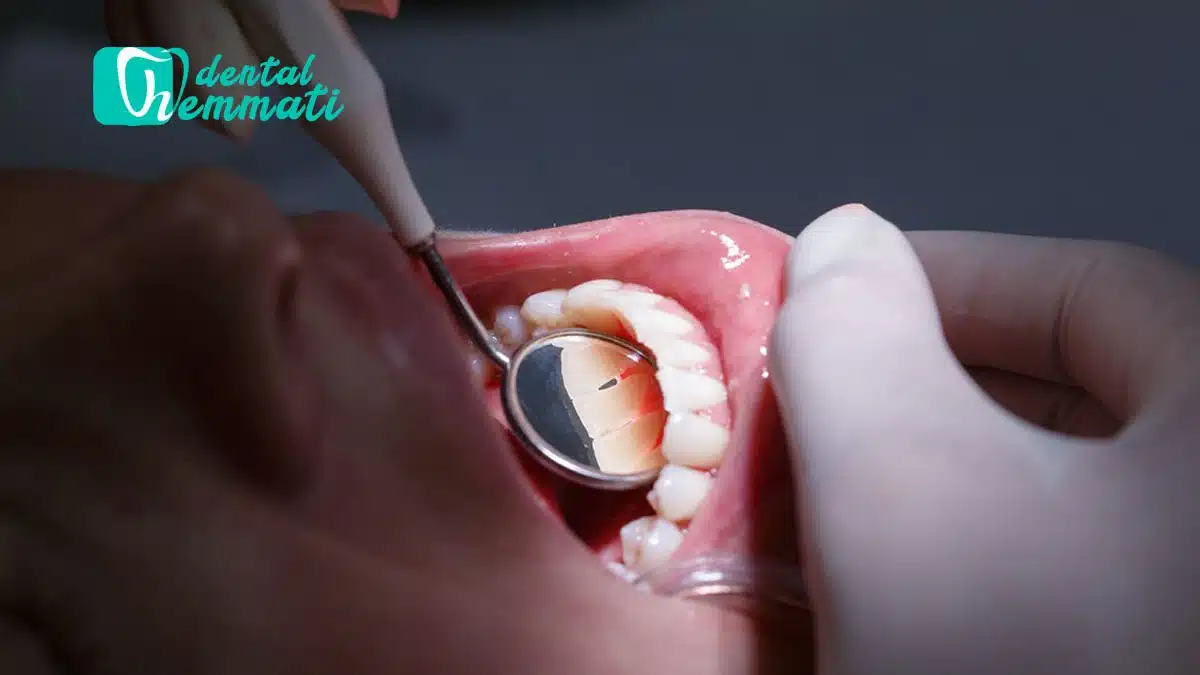 اگر لثه تحلیل رفته باشد، ایمپلنت ممکن است؟