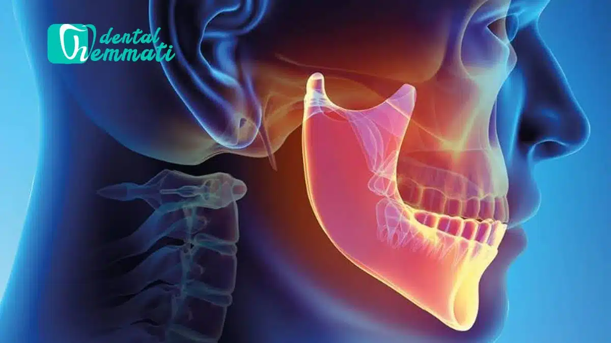 کاشت ایمپلنت و بازسازی استخوان فک
