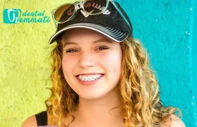 از زیبایی تا عملکرد دهان