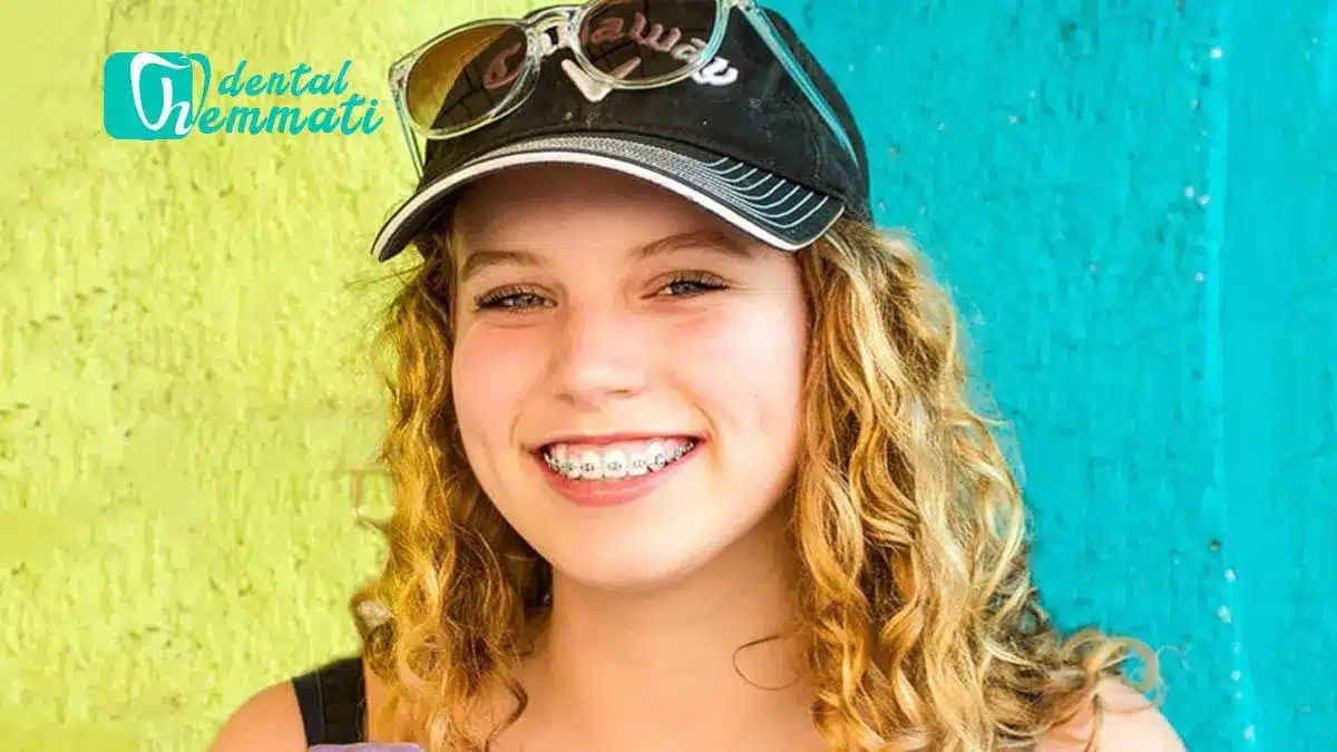 از زیبایی تا عملکرد دهان