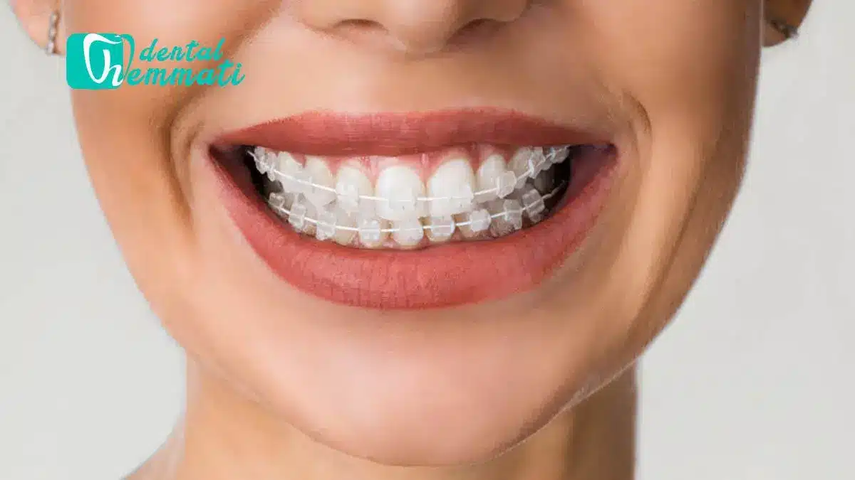 از زیبایی تا عملکرد دهان