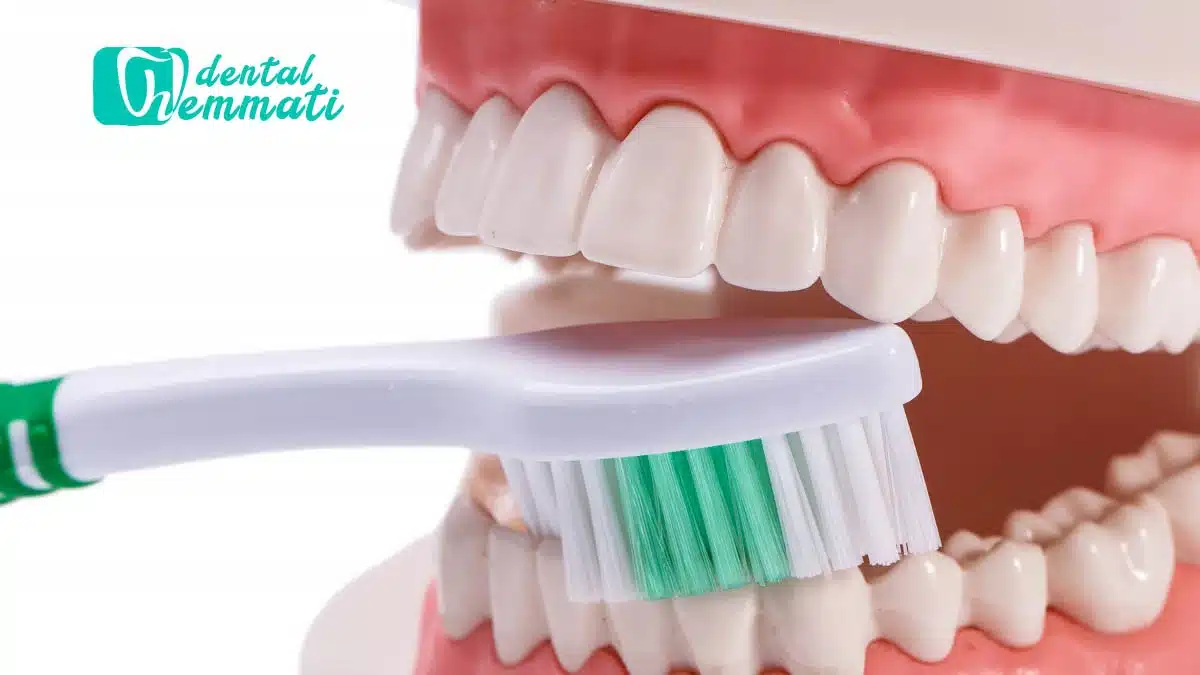 تمیز کردن ایمپلنت